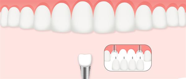 濟南口腔醫(yī)學(xué)專業(yè)學(xué)校是什么層次的學(xué)校？學(xué)校怎么樣？